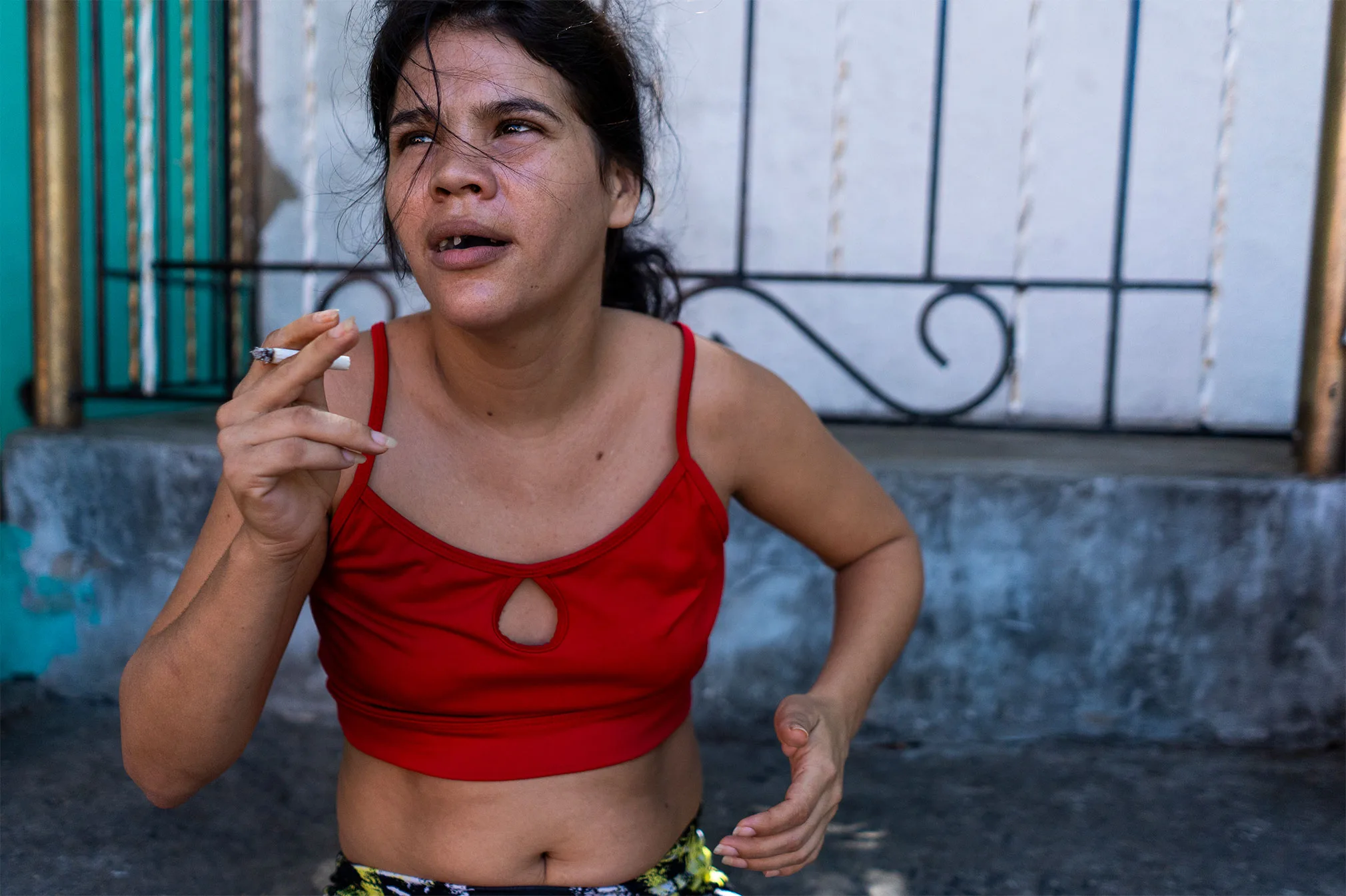 Yeideline Lozano, hija de Yeimi Lozano. Desarrolló la enfermedad hace tres años y desde entonces es cuidada por su madre. Foto: Charlie Cordero.